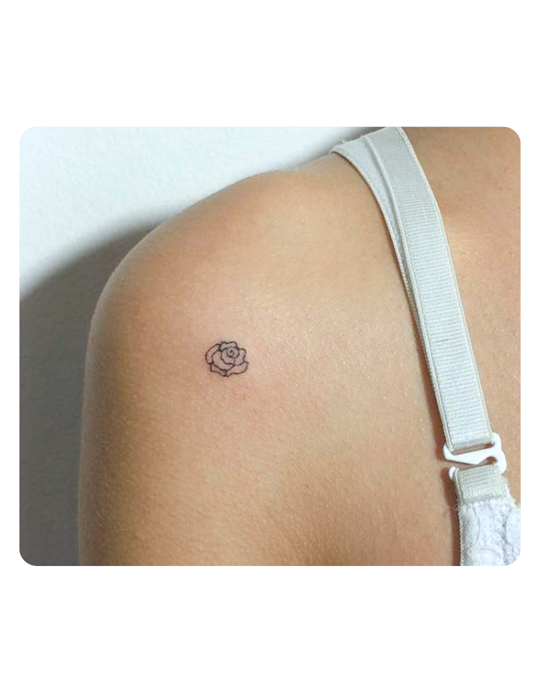 Antes eliminación de tatuajes